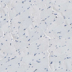 Invitrogen DAXX Polyclonal Antibody 100 &mu;L; Unconjugated:Antibodies,