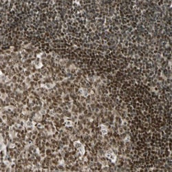 Invitrogen DAXX Polyclonal Antibody 100 &mu;L; Unconjugated:Antibodies,