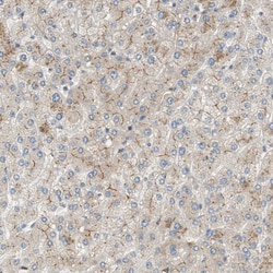 Invitrogen ALPL Polyclonal Antibody 100 &mu;L; Unconjugated:Antibodies,