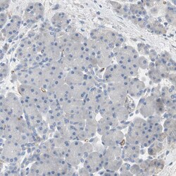 Invitrogen ALPL Polyclonal Antibody 100 &mu;L; Unconjugated:Antibodies,