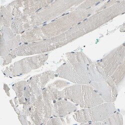 Invitrogen NFATC2 Polyclonal Antibody 100 &mu;L; Unconjugated:Antibodies,