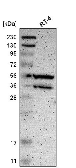 Invitrogen PPP3CB Polyclonal Antibody 100 &mu;L | Buy Online | Invitrogen&trade; | Fisher Scientific