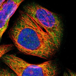 Invitrogen PARP14 Polyclonal Antibody 100 &mu;L; Unconjugated:Antibodies,