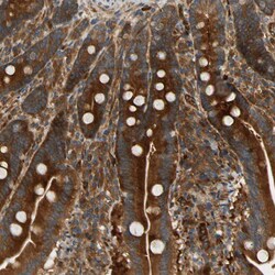 Invitrogen PARP14 Polyclonal Antibody 100 &mu;L; Unconjugated:Antibodies,