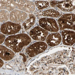 Invitrogen PARP14 Polyclonal Antibody 100 &mu;L; Unconjugated:Antibodies,