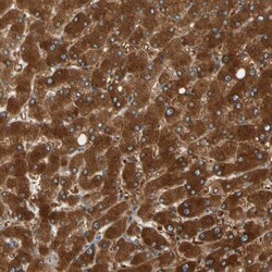 Invitrogen PARP14 Polyclonal Antibody 100 &mu;L; Unconjugated:Antibodies,