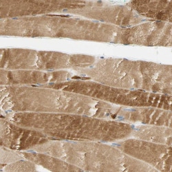 Invitrogen PARP14 Polyclonal Antibody 100 &mu;L; Unconjugated:Antibodies,