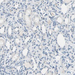 Invitrogen CD23 Polyclonal Antibody 100 &mu;L | Buy Online | Invitrogen&trade; | Fisher Scientific