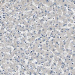 Invitrogen CD23 Polyclonal Antibody 100 &mu;L | Buy Online | Invitrogen&trade; | Fisher Scientific