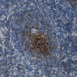 Invitrogen CD23 Polyclonal Antibody 100 &mu;L | Buy Online | Invitrogen&trade; | Fisher Scientific