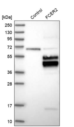 Invitrogen CD23 Polyclonal Antibody 100 &mu;L | Buy Online | Invitrogen&trade; | Fisher Scientific