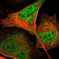 Invitrogen Ephrin B2 Polyclonal Antibody 100 &mu;L; Unconjugated:Antibodies,