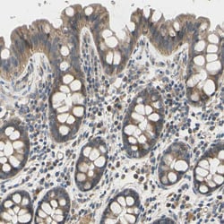 Invitrogen Ephrin B2 Polyclonal Antibody 100 &mu;L; Unconjugated:Antibodies,