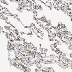 Invitrogen Ephrin B2 Polyclonal Antibody 100 &mu;L; Unconjugated:Antibodies,