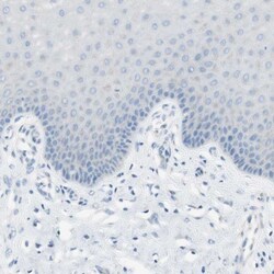 Invitrogen CDHR5 Polyclonal Antibody 100 &mu;L; Unconjugated:Antibodies,