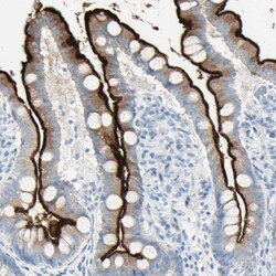 Invitrogen CDHR5 Polyclonal Antibody 100 &mu;L; Unconjugated:Antibodies,
