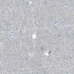 Invitrogen CD79b Polyclonal Antibody 100 &mu;L; Unconjugated:Antibodies,