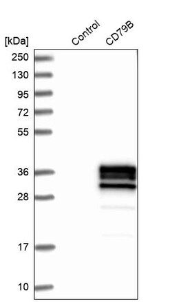 Invitrogen CD79b Polyclonal Antibody 100 &mu;L; Unconjugated:Antibodies,