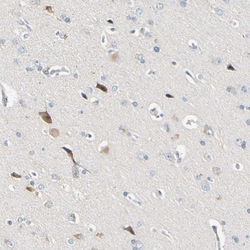 Invitrogen LDLR Polyclonal Antibody 100 &mu;L; Unconjugated:Antibodies,