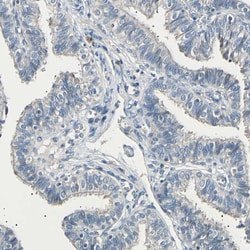 Invitrogen LDLR Polyclonal Antibody 100 &mu;L; Unconjugated:Antibodies,