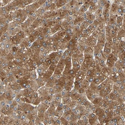 Invitrogen LDLR Polyclonal Antibody 100 &mu;L; Unconjugated:Antibodies,