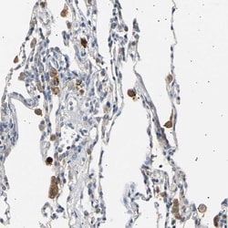 Invitrogen LDLR Polyclonal Antibody 100 &mu;L; Unconjugated:Antibodies,