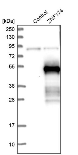 Invitrogen ZNF174 Polyclonal Antibody 100 &mu;L | Buy Online | Invitrogen&trade; | Fisher Scientific