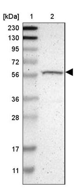 Invitrogen RPS6KB2 Polyclonal Antibody 100 &mu;L; Unconjugated:Antibodies,