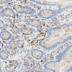 Invitrogen CD63 Polyclonal Antibody 100 &mu;L; Unconjugated:Antibodies,
