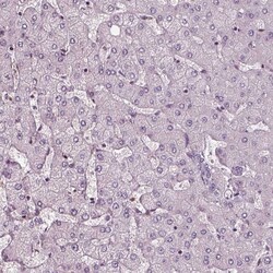 Invitrogen Chitotriosidase Polyclonal Antibody 100 &mu;L; Unconjugated:Antibodies,