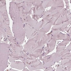 Invitrogen Chitotriosidase Polyclonal Antibody 100 &mu;L; Unconjugated:Antibodies,