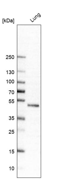 Invitrogen Chitotriosidase Polyclonal Antibody 100 &mu;L; Unconjugated:Antibodies,
