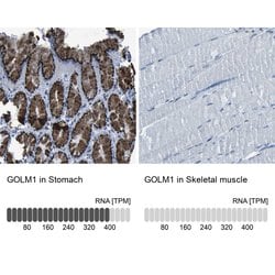 GOLPH2 Polyclonal Antibody, Invitrogen 100 &mu;L; Unconjugated:Antibodies,