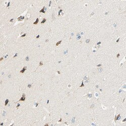 Invitrogen TAOK2 Polyclonal Antibody 100 &mu;L | Buy Online | Invitrogen&trade; | Fisher Scientific