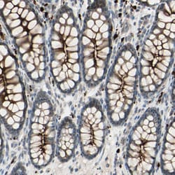 Invitrogen LMTK2 Polyclonal Antibody 100 &mu;L; Unconjugated:Antibodies,