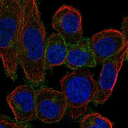 Invitrogen LAT Polyclonal Antibody 100 &mu;L; Unconjugated:Antibodies,