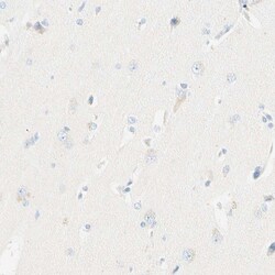 Invitrogen LAT Polyclonal Antibody 100 &mu;L; Unconjugated:Antibodies,