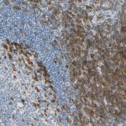 Invitrogen LAT Polyclonal Antibody 100 &mu;L; Unconjugated:Antibodies,
