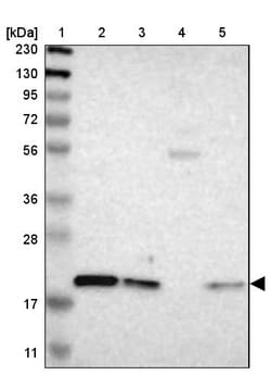 Invitrogen LAT Polyclonal Antibody 100 &mu;L; Unconjugated:Antibodies,