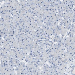 Invitrogen Langerin Polyclonal Antibody 100 &mu;L | Buy Online | Invitrogen&trade; | Fisher Scientific