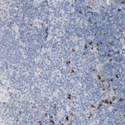 Invitrogen Langerin Polyclonal Antibody 100 &mu;L | Buy Online | Invitrogen&trade; | Fisher Scientific