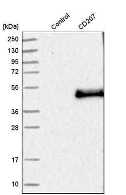 Invitrogen Langerin Polyclonal Antibody 100 &mu;L | Buy Online | Invitrogen&trade; | Fisher Scientific