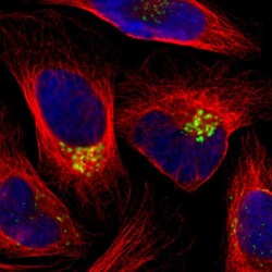 Invitrogen GALNT2 Polyclonal Antibody 100 &mu;L; Unconjugated:Antibodies,
