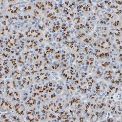 Invitrogen GALNT2 Polyclonal Antibody 100 &mu;L; Unconjugated:Antibodies,