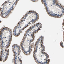 Invitrogen GALNT2 Polyclonal Antibody 100 &mu;L; Unconjugated:Antibodies,