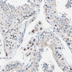 Invitrogen GALNT2 Polyclonal Antibody 100 &mu;L; Unconjugated:Antibodies,