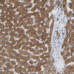 Invitrogen ERLIN1 Polyclonal Antibody 100 &mu;L; Unconjugated:Antibodies,
