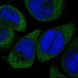 Invitrogen DFNA5 Polyclonal Antibody 100 &mu;L; Unconjugated:Antibodies,
