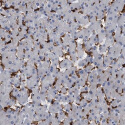 Invitrogen CD300a Polyclonal Antibody 100 &mu;L; Unconjugated:Antibodies,