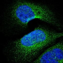 VPARP Polyclonal Antibody, Invitrogen 100 &mu;L; Unconjugated:Antibodies,